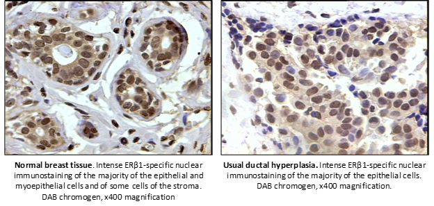 molendocrinology_EstrogenReceptor_beta